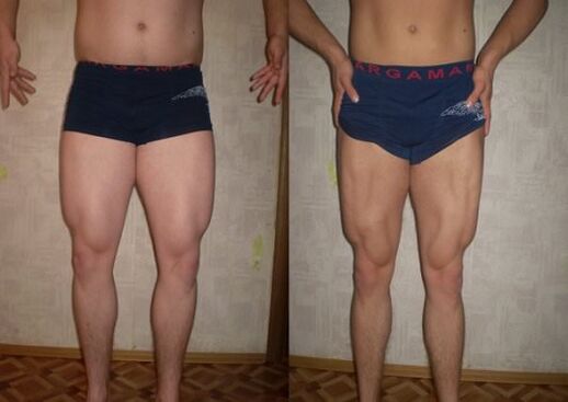 Before and after following the ketogenic diet